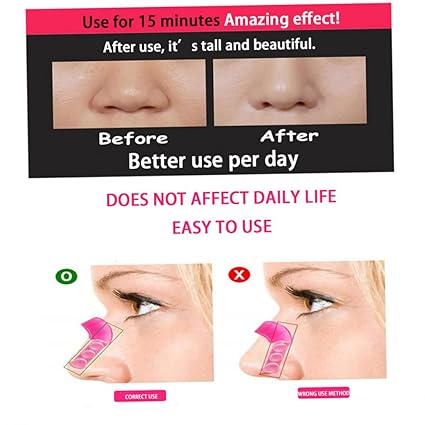 Nose Up Clip Bridge Lifting Shaping Shaper Clipper Straightening Beauty Clip / Magic Nose Shaper Clip - Image 3